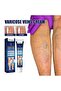 Varicose Veins Cream – Refreshing Care for Swollen & Tired Legs - 6