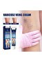 Varicose Veins Cream – Refreshing Care for Swollen & Tired Legs - 4