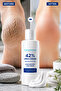 Intensive Care for Cracked, Dry, and Hardened Heels: a Softer and Smoother Heel Appearance with 42% Urea and 2% Salicylic Acid - 7