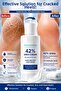 Intensive Care for Cracked, Dry, and Hardened Heels: a Softer and Smoother Heel Appearance with 42% Urea and 2% Salicylic Acid