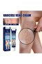 Varicose Veins Cream – Daily Leg Relief & Refreshing Care - 5