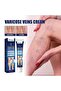 Varicose Veins Cream – Refreshing Care for Swollen & Tired Legs - 5