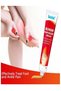 Bunion Pain Relief Cream For & Toe Swelling - Foot Back, Neck, Knee, Hand, Wrist, Shoulder, Feet - 2