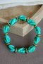 Ebruli Marble Patterned Gold Detailed Acrylic Beaded Rubber Bracelet - 3
