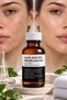 15% Lactic Acid + 15% Salicylic Acid Power in One: Professional Hybrid Peeling Effect Against Pores, Blackheads, Acne Appearance, and Skin Imperfections - 5
