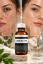 Effective Exfoliation with 10% Lactic Acid: Removes Dead Skin Cells, Leaves Skin Smoother, Brighter, and Renewed - 4