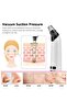 Electric Black Head Pimple Vacume Removal Tool with Hot Compress USB Rechargeable - 5