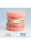 OrthoDots CLEAR Wax Alternative, Sticks Better Than Dental Wax 2pk (24ct) | Sticks Better than Dental Wax, 24Hr Protection, Moisture Activated for Braces & Clear Aligners - 4