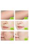 T14 5 in 1 IPL Hair Removal Device, 3℃ Ice Cooling Laser Hair Removal, 500,000 Flashes 0.5s/Flash Painless Hair Removal Device Remove Acne/Skin Rejuvenation for Whole Body Bikini Face Arm Armpit - 2