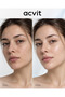 Glycolic Acid Skin Cleansing Tonic Anti-Blemish, Tone Equalizer, Purifying 200 ml - 3