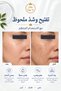 Anti-Blemish, Brightening & Firming 3-Piece Soap Care Set |   Kojic Acid + Collagen + Rice Oil 315g - 4
