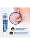 3Pcs Wart Remover Ointment 20g – Natural Herbal Skin Care Ointment for Common Warts and Skin Tags, Convenient Portable Tube, Easy Home Application, and Practical Packaging for Personal - 7