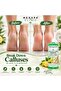 Callus and Corn Remover Liquid 1L – Lemon Fresh Scent Foot Care Solution, Deep Cleansing, Instantly Softens Hard Skin, Corns & Cracked Heels, Exfoliating Foot Soak for Men & Women. - 3