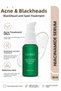 Niacinamide Serum Set Anti-Blemish Blackhead Balancing Smoothing Care 2-Piece Set - 2