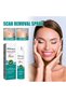 Scar Care Spray 20g – Medical Grade Skincare Spray for Convenient Daily Application, Designed to Support Skin Renewal and Help Improve the Visible Appearance of Different Types o - 6