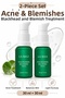 Niacinamide Serum Set Anti-Blemish Blackhead Balancing Smoothing Care 2-Piece Set