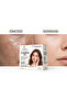 Acn Pro Face Wash Gel – Microbiome Supporting, Sebum Balancing Purifying Cleansing Gel for Acne and Prone Skin – 500 ml