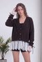 Women's Lace Detailed Buttoned Knitwear Cardigan V-Neck Oversize Beige, Burgundy, Brown, Anthracite