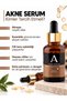 Acne and Anti-Acne Pore Tightening Skin Serum Salicylic Acid, Niacinamide 30 ml - 2