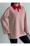 Striped Oversize Polo Collar Tunic with Collar Detail - 2