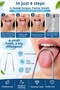 Stainless Steel Tongue Cleaner U-Type Tongue Scraper Oral Care Tool - 2