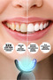 Il32 Blue Red Light Technology 32 Leds 3 Whitening Gels Fast Teeth Whitening Kit - 7