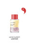 Kurutucu Losyon 30 ml