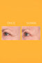 Prevage Progressive Renewal Treatment 4 X 10 ml – Progressive Skin Renewal Peeling Serum - 5