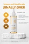 Salicylic Acid Toner - Pore Tightening Anti Acne and Acne Blackhead Removal - AHA BHA - 3