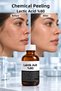 A Powerful Step in Professional Skincare: Chemical Peeling Containing 80% Lactic Acid - 3