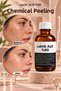 A Powerful Step in Professional Skincare: Chemical Peeling Containing 80% Lactic Acid - 2