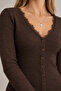Collar Lace Detailed Buttoned Mini Dress |   Mkw2811498-1 - 4