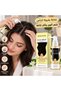 سيروم فروة الرأس MŌND’SUB Scalp Serum 🌿✨