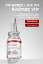 Anti-Redness Soothing Skin Care Set - 10% Azelaic Acid, 5% Calamine, 1% Ectoin, Azulene - 5