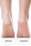 By Sweden Herbal Heel Crack Cream 75 ml - 2