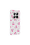 Xiaomi Redmi Note 15 Pro Plus Case with Floral and Bow Pattern, Camera Raised, Premium - 2
