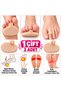 Skin Color 1 Pair Silicone Metatarsal Toe Pad for Women Men with Finger Ring Forefoot Support Protection Pad - 5