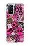Redmi Note 11 / 11S Compatible Pink Star Zebra Printed Transparent Phone Case