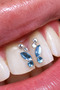Tooth Diamond with Blue Butterfly Pattern (Special Set Made from Austrian Crystals) - 3