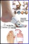 Foot Big Toe Hallux Valgus Night Splint Corrector Foot Big Toe Bone Protrusion Regulator Apparatus Splint - 3