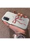 Redmi Note 11 Pro 4G/5G Compatible Romantic Bow and Star Case, Fashionable, Secure Protection - 2
