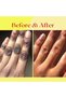 1000ML Turmeric Oil for Super Whitening Skin, Essential Brightening Oil for Face & Body Parts Dark Spots, Clear Skin, Fights Acne, Clear Knuckles, Evens Skin Tone, Body Oil for Private Parts Men Women - 5