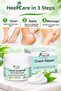 Rose Cracked Heel Cream 150 g—For Dry, Rough Feet: Softening Foot and Heel Care Cream - 4