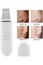 Ultrasonic Skin Cleaner Deep Cleansing, Blackhead Removal, and Exfoliation - | (C-105) - 3