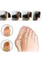 Medical Hallux Valgus Night Splint, Foot Bunion Protector, 1 Pair (Right and Left), Device for Hallux Valgus (Bunion) Correction. - 5