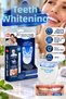 LED Teeth Whitening Kit – 20-Minute Treatment, 360° Coverage