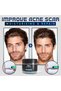 Hintohu Men's Anti-Wrinkle Smoothing Cream for Men with Damaged, Sensitive Skin GEN01 - 3