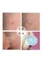 Breylee Acne Patch - Acne Pimple Patch 22 Pieces - 3