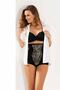 Lace Meddle Firming Slip Corset Beige - 2