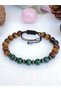 Natural Stone Tiger Eye-malachite-hematite Stone Bracelet-migraine Bracelet Akalite - 4